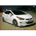 sequence quantum edition kit hyundai elantra 2010-13